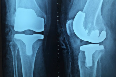 orthopedic EHR - x-ray orthopedic EHR - x-ray