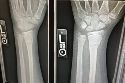 post-acute